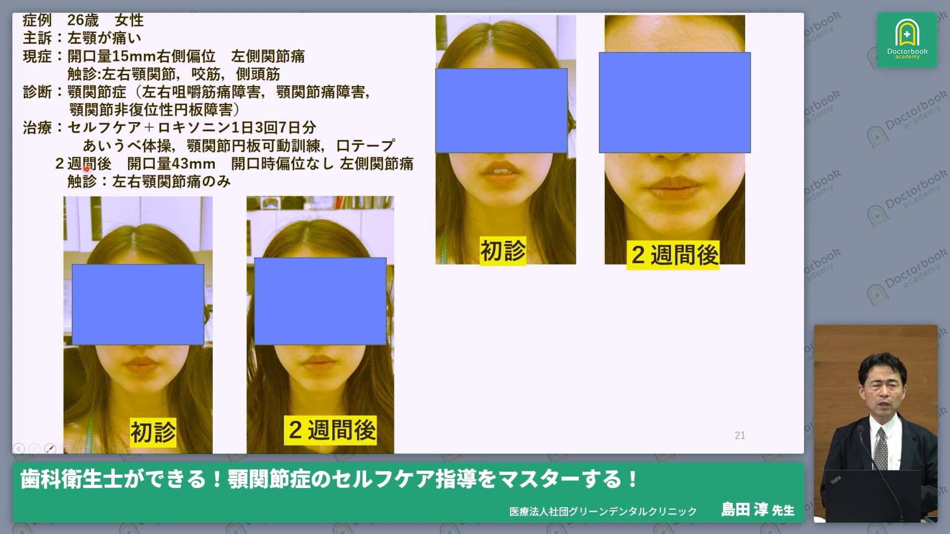  臨床知見録_症例_筋膜痛・関節痛・開口障害への個別アプローチ