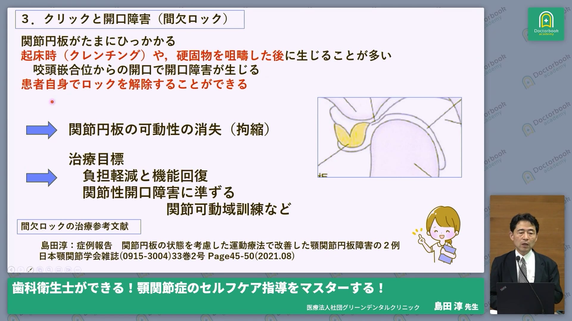  臨床知見録_ガイドライン・論文_間欠ロックへの保存的治療アプローチ