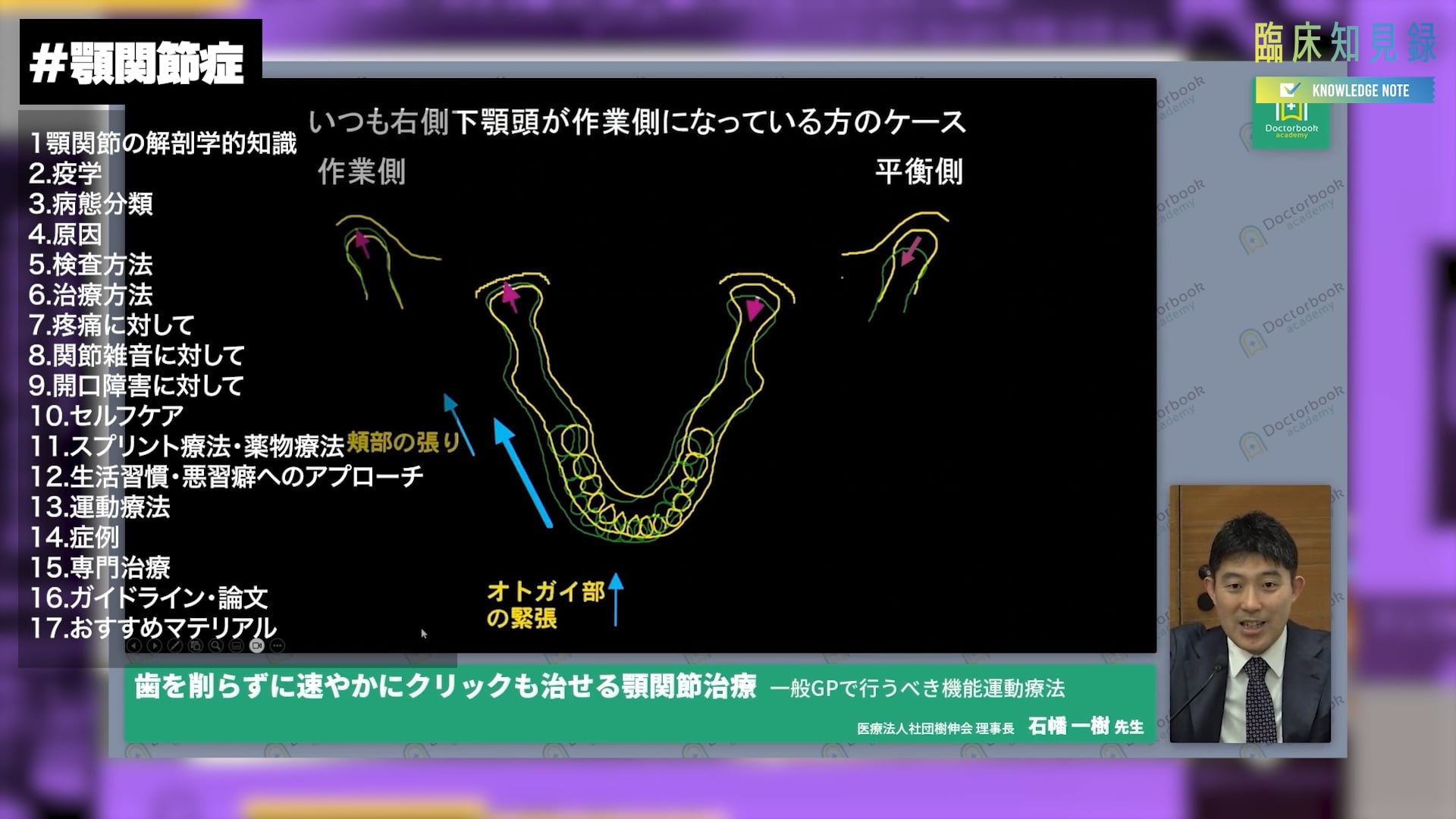 臨床知見録_顎関節症_CM
