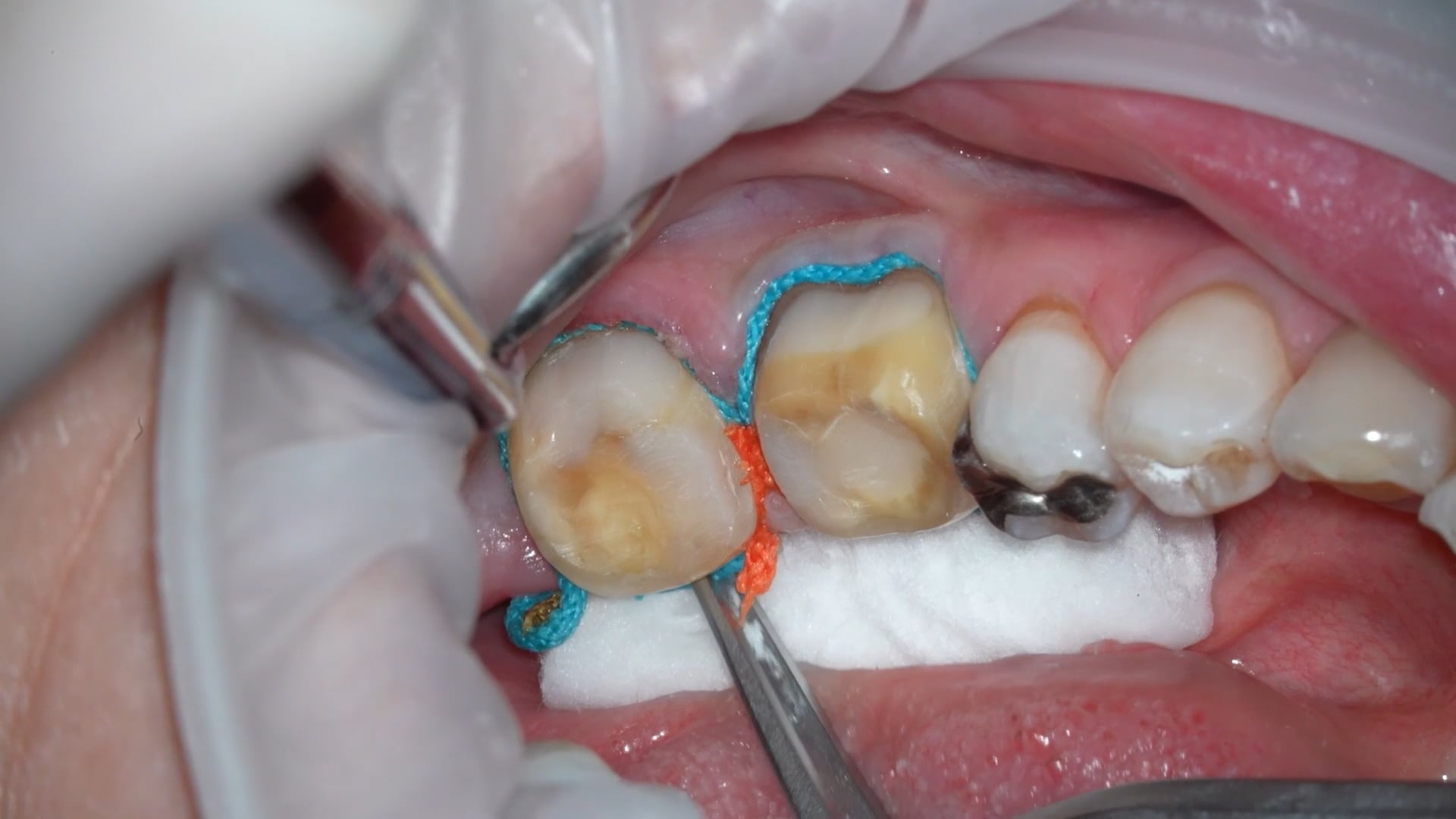 【GPB_crown_llp_090】印象