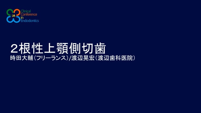 2根性上顎側切歯｜時田大輔先生(Archives)