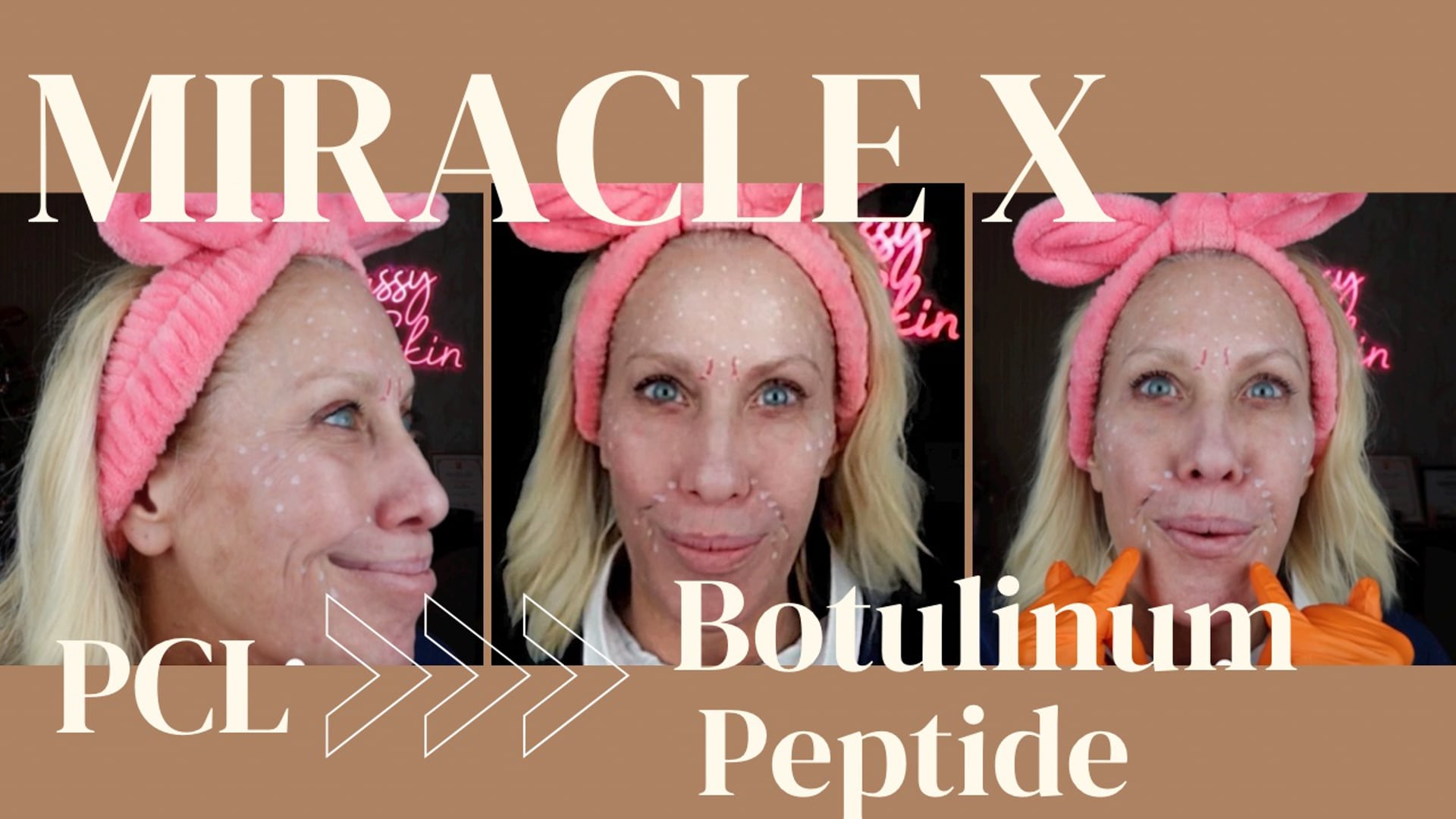 Miracle X - Why it’s more than just PCL