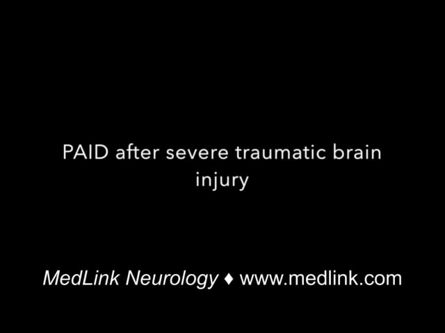 Paroxysmal autonomic instability with dystonia after severe traumatic brain injury
