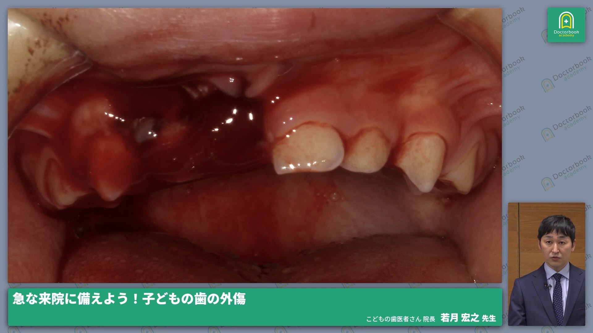  臨床知見録_小児の外傷_よくある受傷シーン
