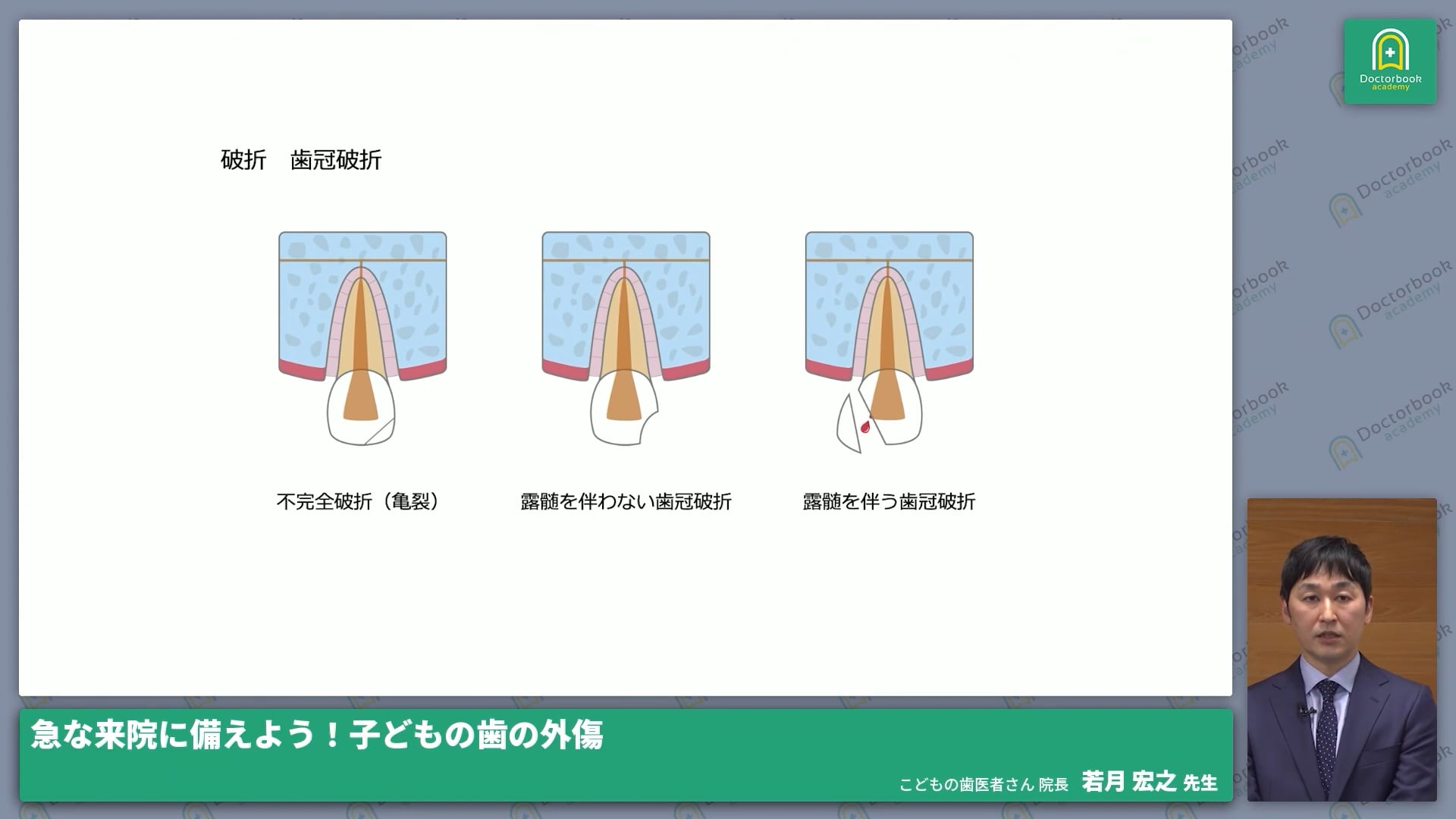  臨床知見録_小児の外傷_破折の分類