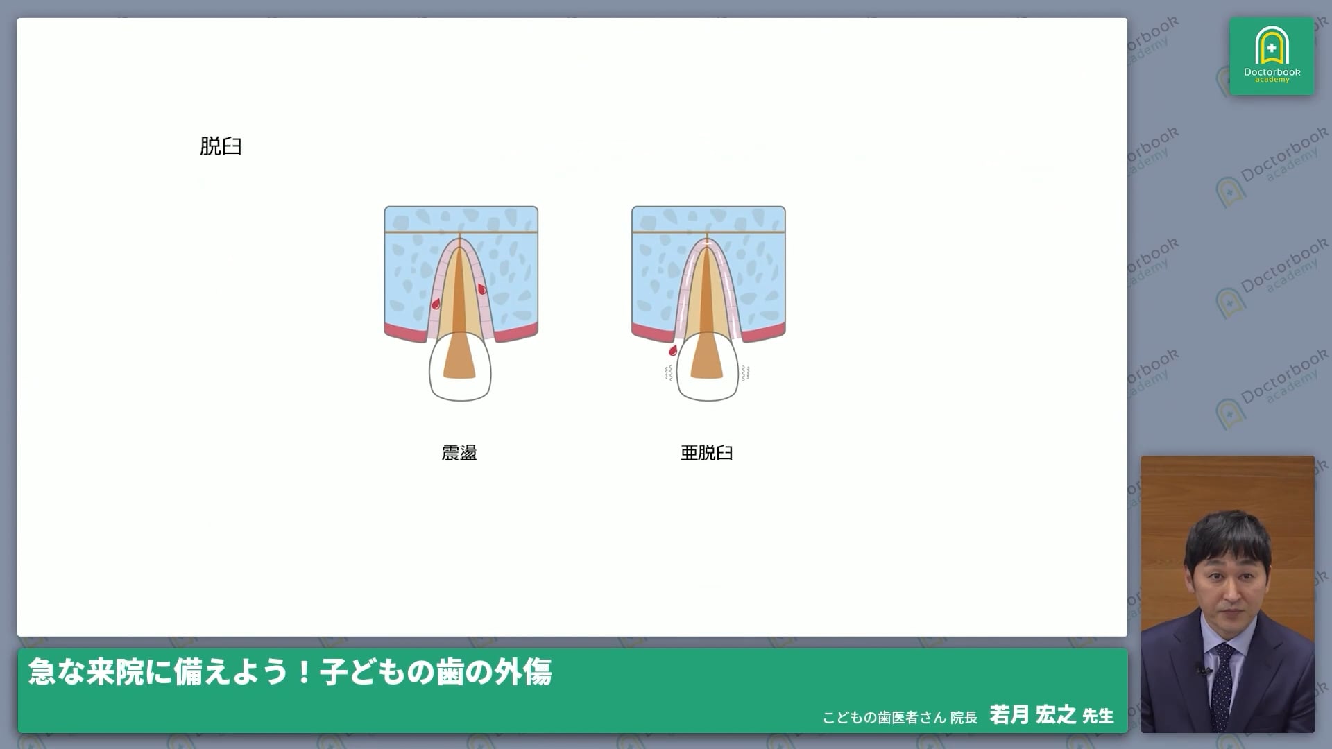  臨床知見録_小児の外傷_脱臼の分類