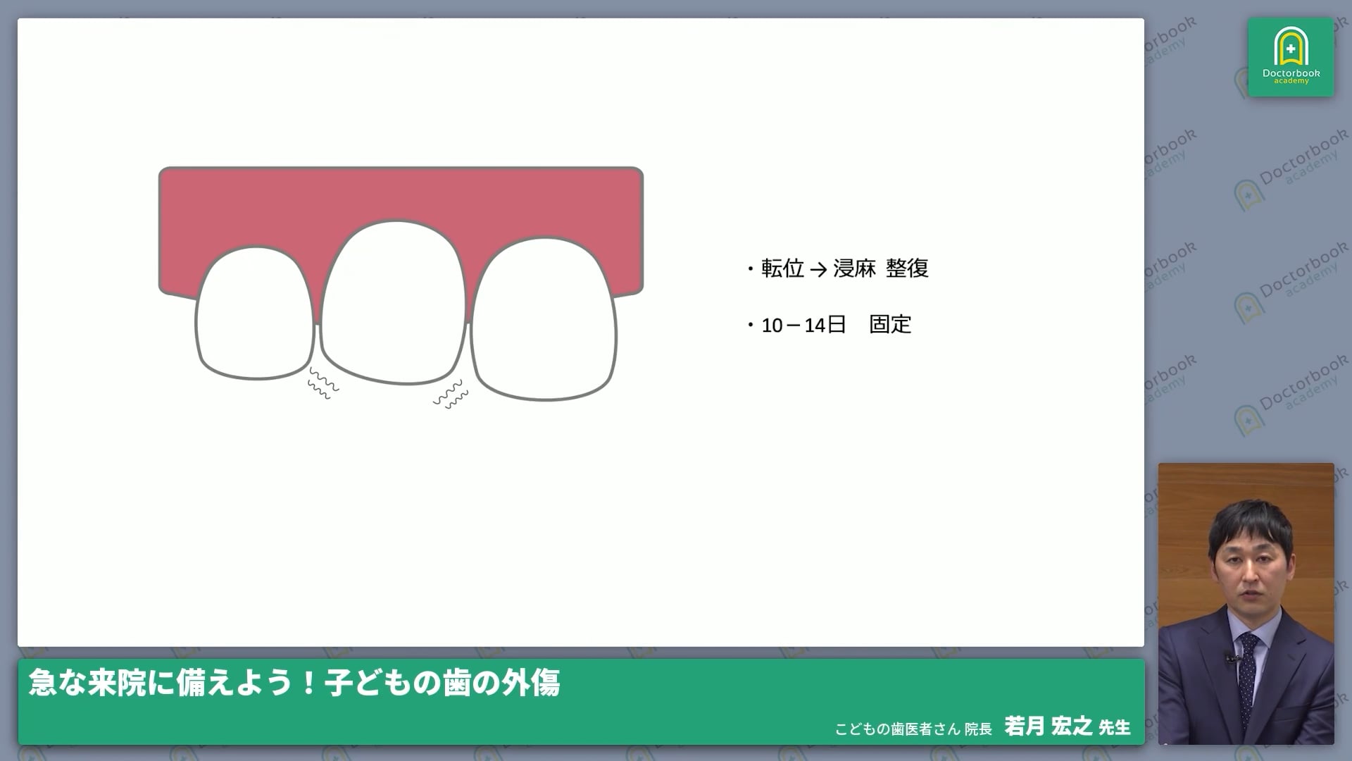  臨床知見録_小児の外傷_側方脱臼・挺出