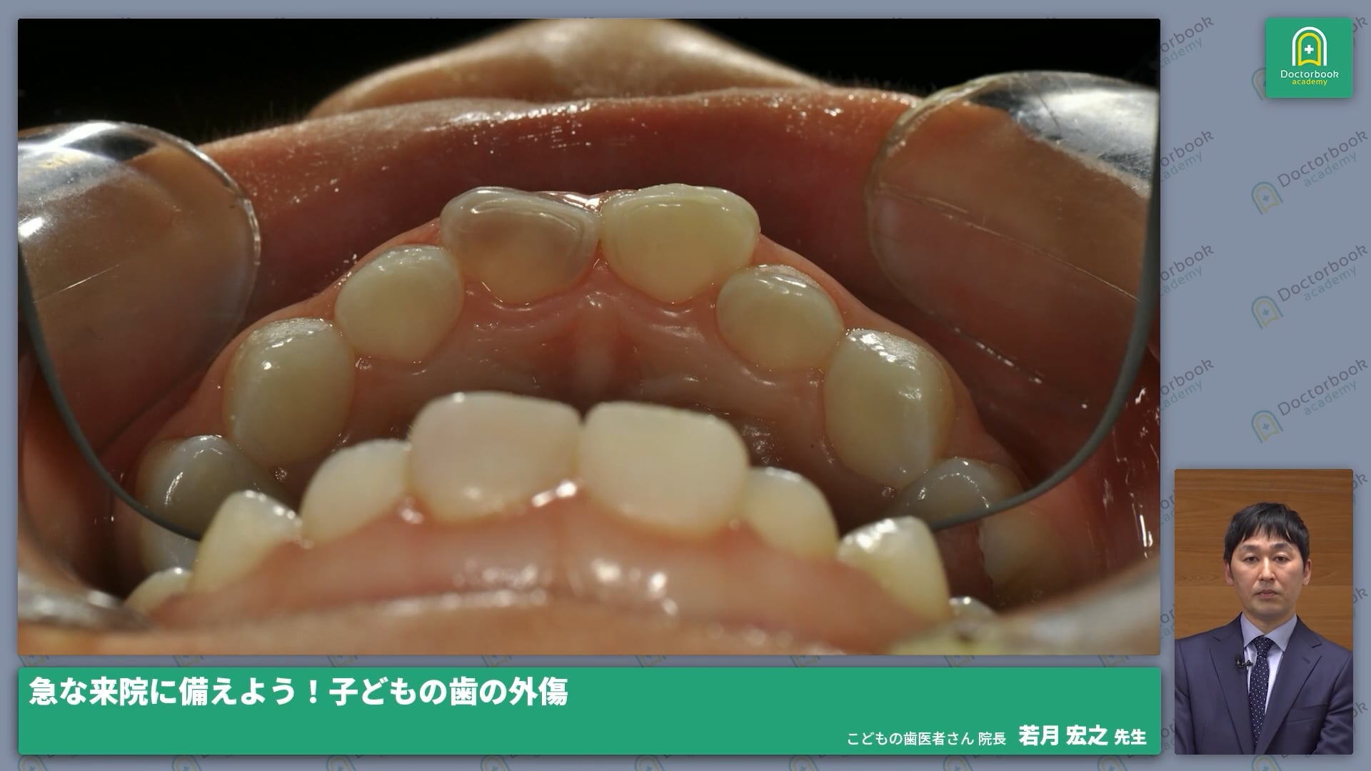  臨床知見録_小児の外傷_予後説明①（変色）