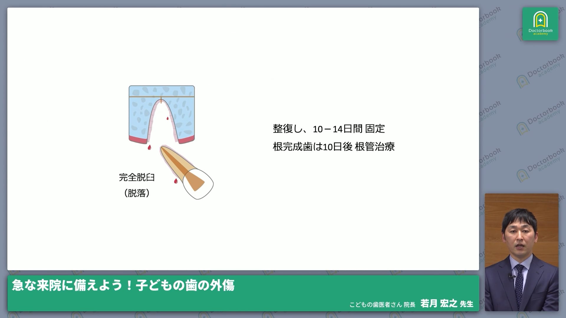  臨床知見録_小児の外傷_完全脱臼
