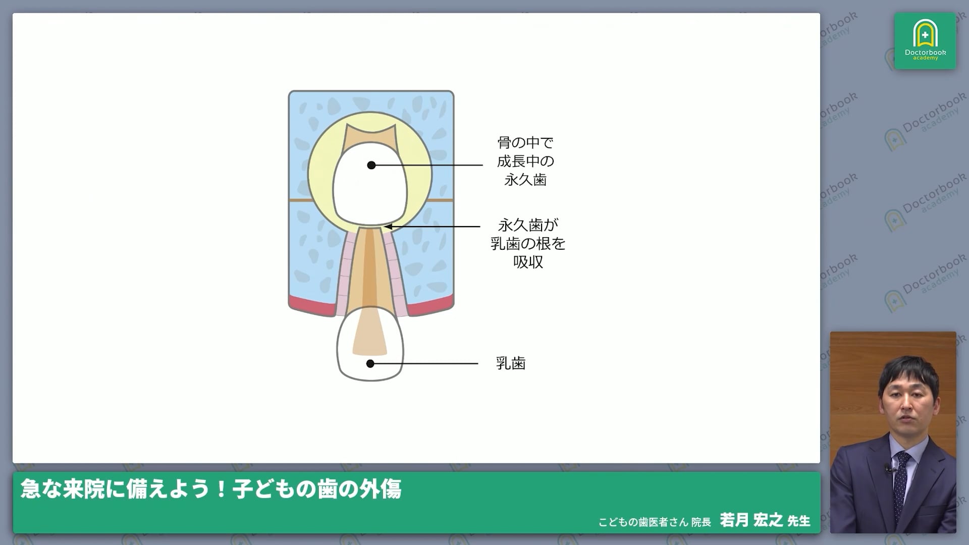  臨床知見録_小児の外傷_予後説明③（永久歯への影響）