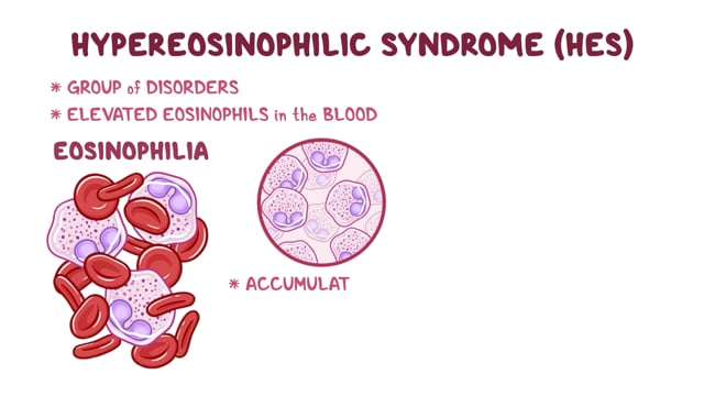 Hypereosinophilic Syndrome