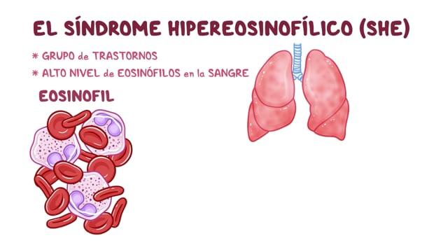 Síndrome hipereosinofílico