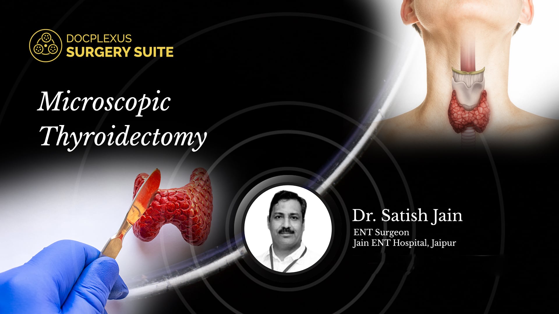 Microscopic Thyroidectomy
