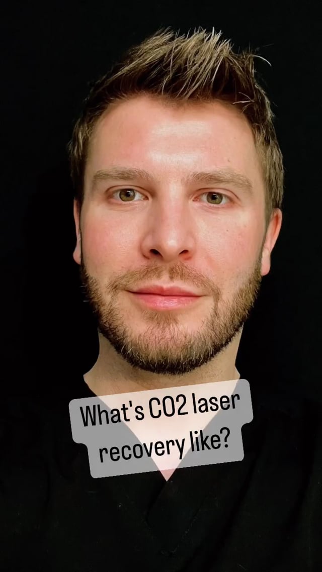 Dr Alex, SONU Clinic coolpeel video thumbnail