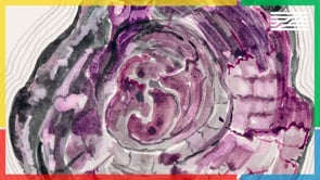 Vignette de la vidéo