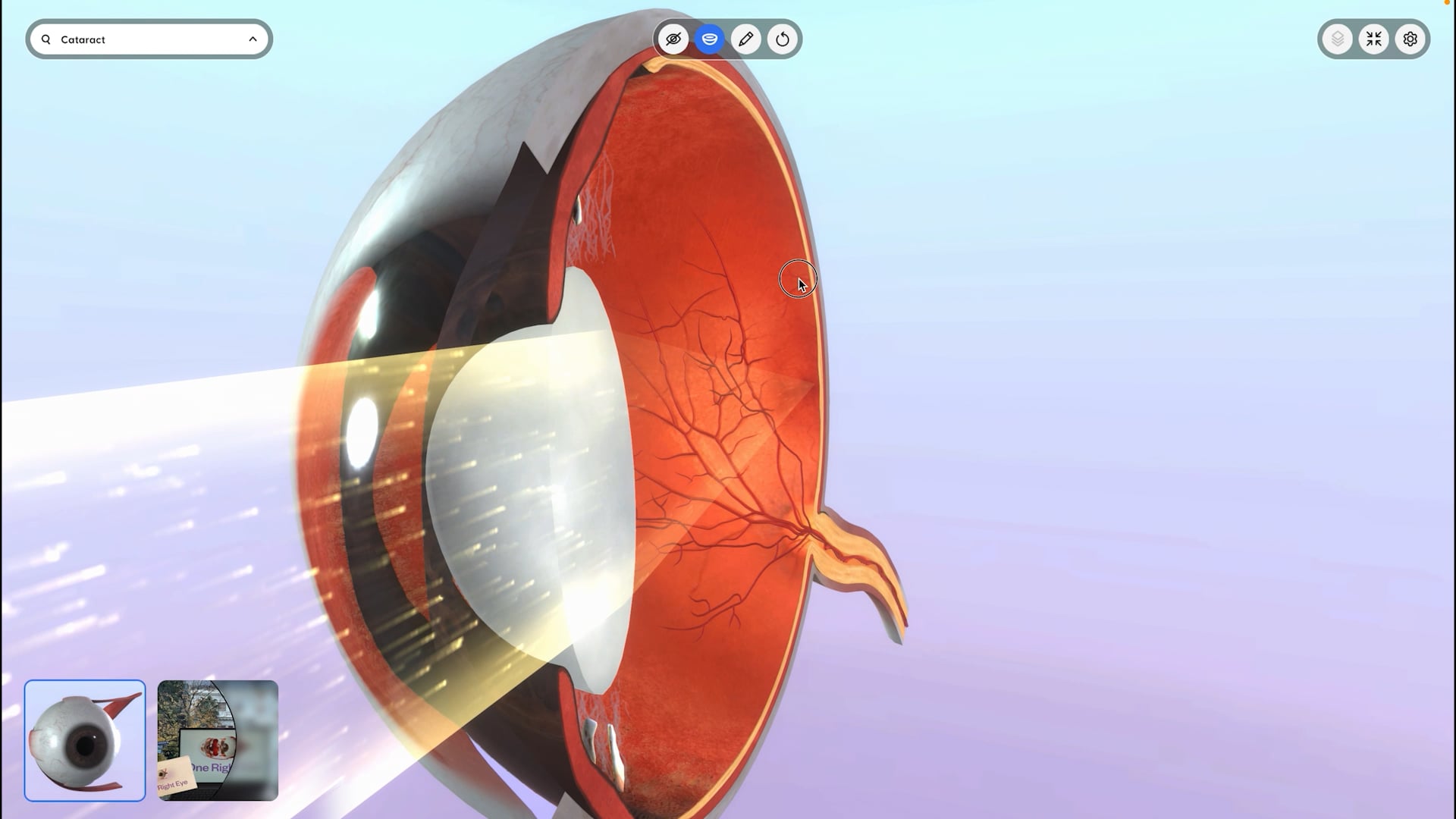 One Right Eye: A Patient Education Tool for Eye Care