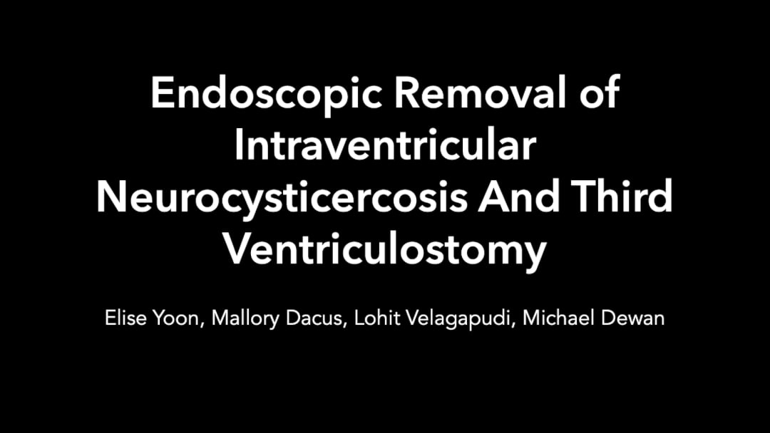 Endoscopic Removal of Intraventricular Neurocysticercosis and Third Ventriculostomy