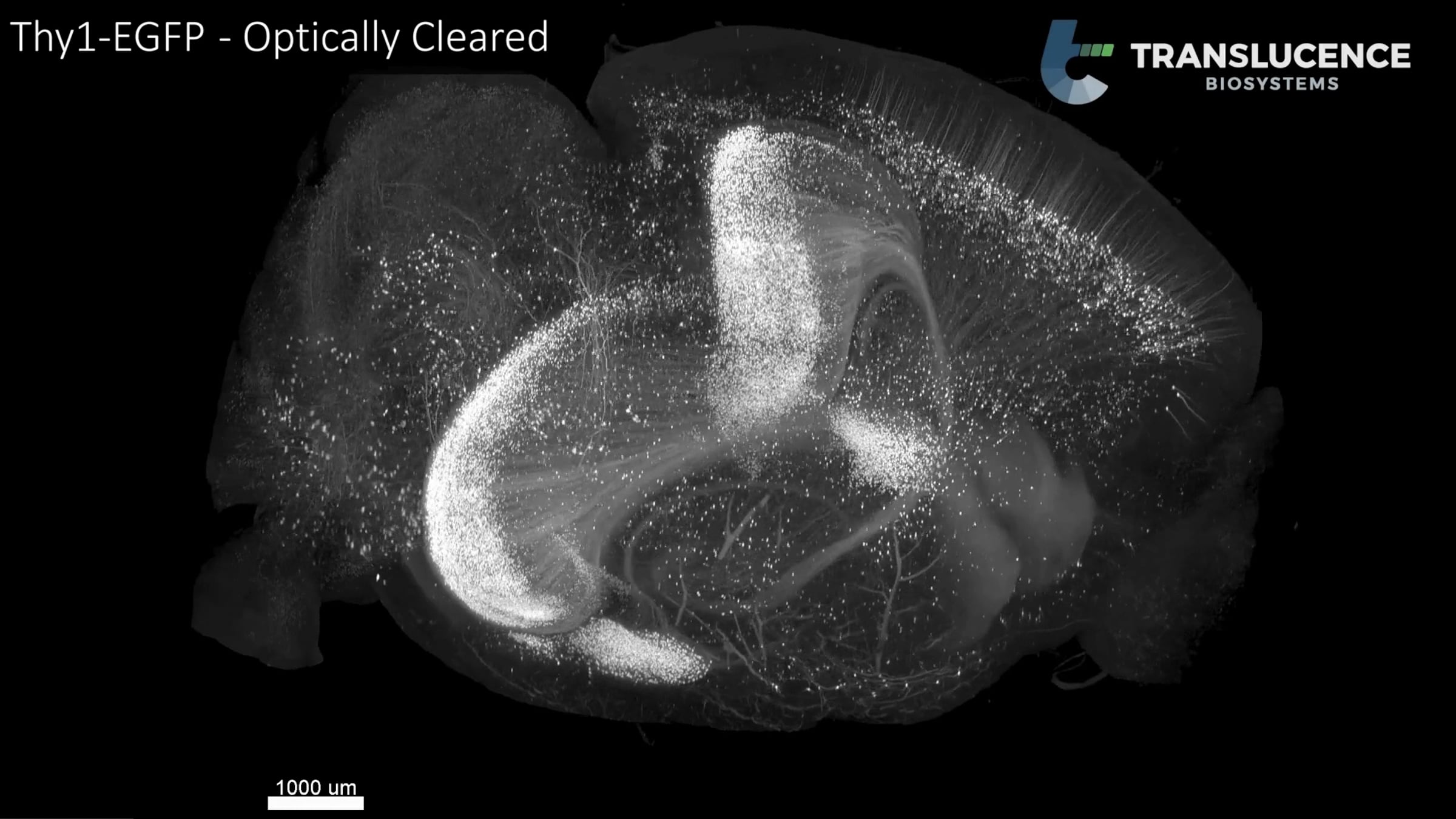 Intact whole-brain imaging of neurons in Thy 1-GFP mouse | Videos ...
