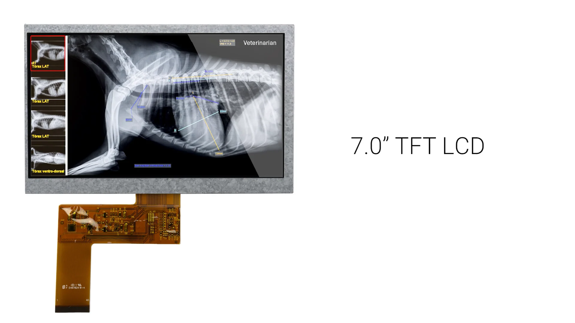 7 inch Premium MVA 800x480 Resolution TFT LCD Display