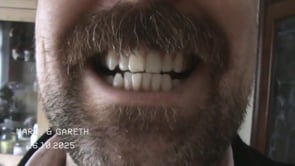 Related Embedded Video Item Thumbnail