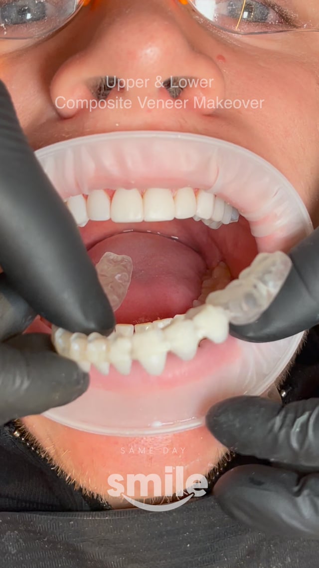 Vimeo Video Thumbnail