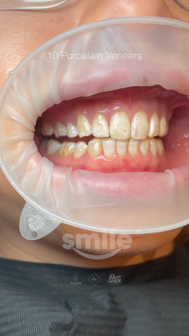 Vimeo Video Thumbnail