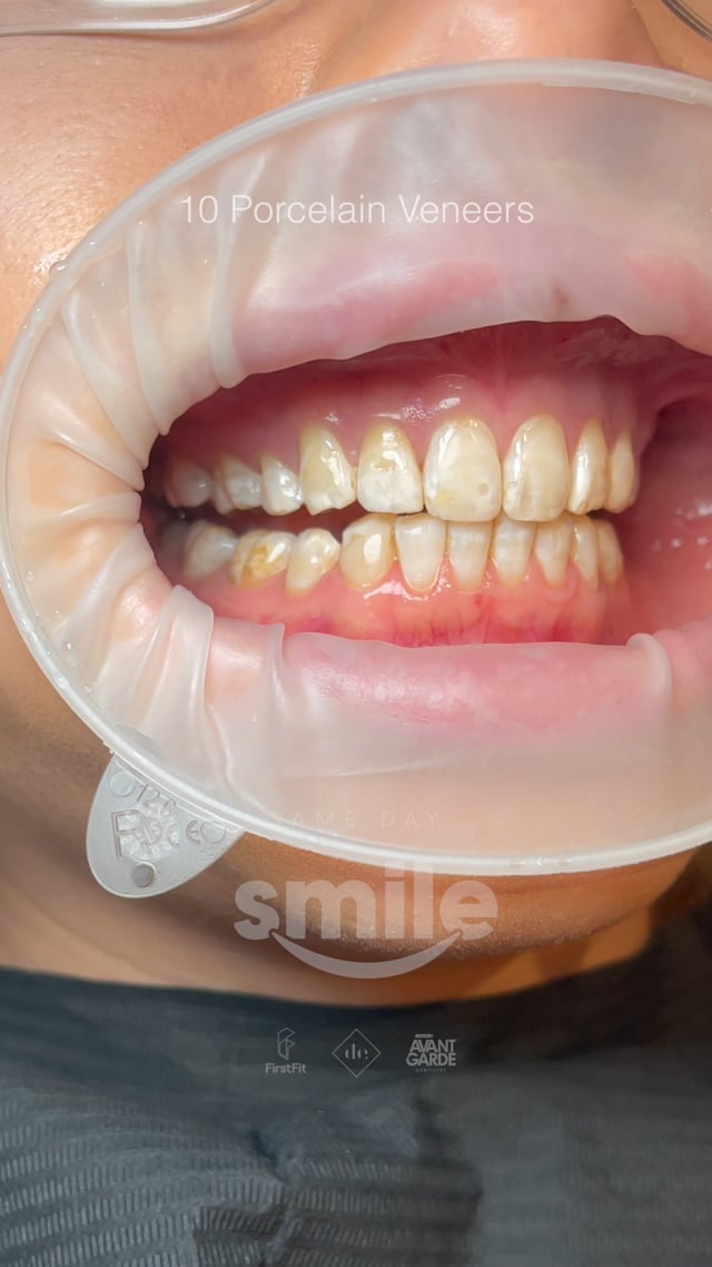 Vimeo Video Thumbnail