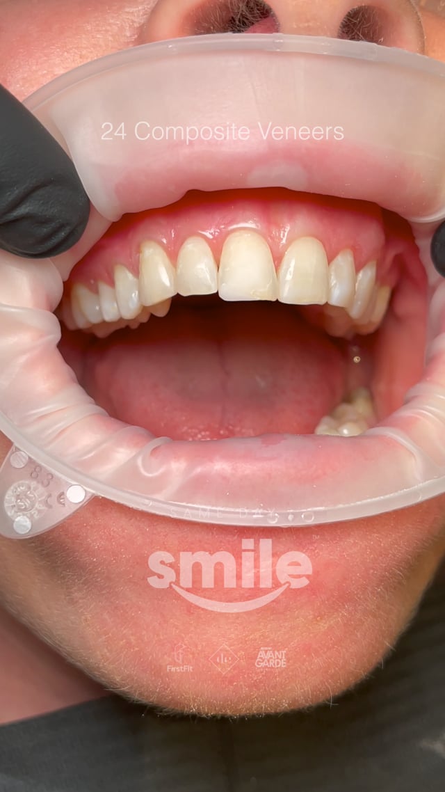 Vimeo Video Thumbnail