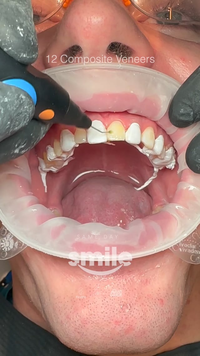 Vimeo Video Thumbnail