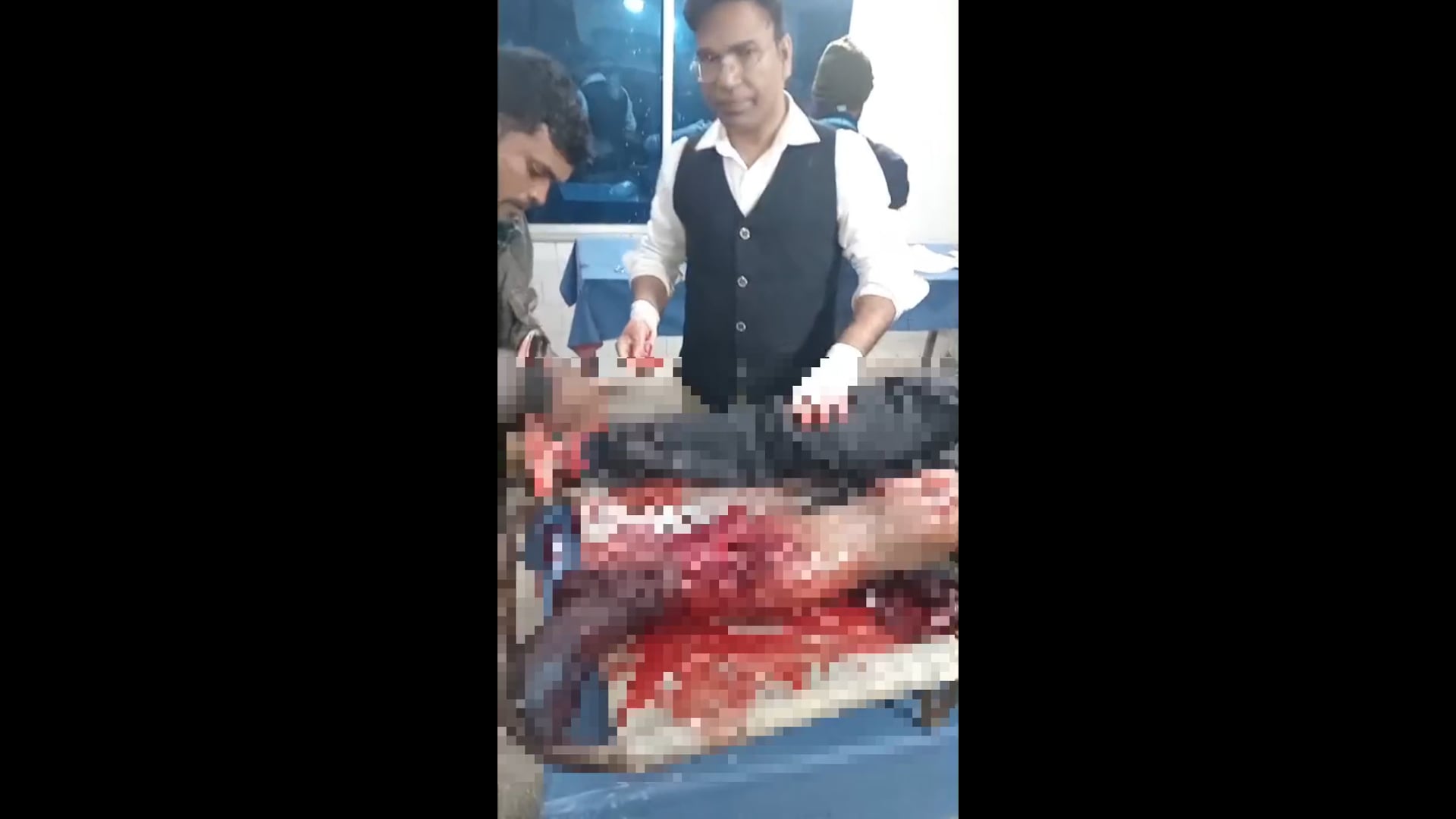 हाईवा की टक्कर से बाइक सवार युवक गंभीर रूप से जख्मी, पटना रेफर