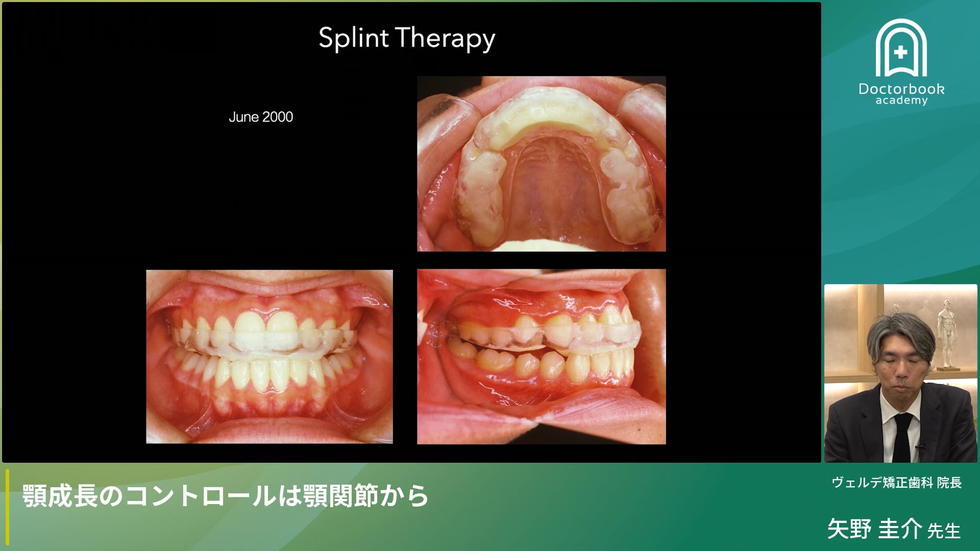 顎成長のコントロールは顎関節から