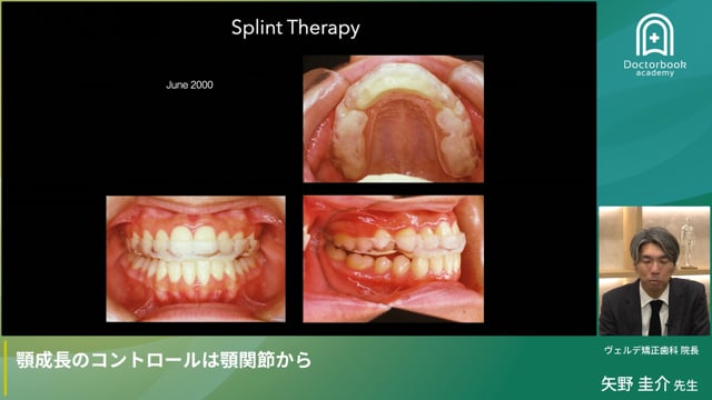 顎成長のコントロールは顎関節から