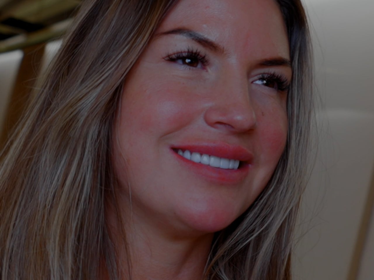 Patient Journey 3D Veneers 9x16 Same Day