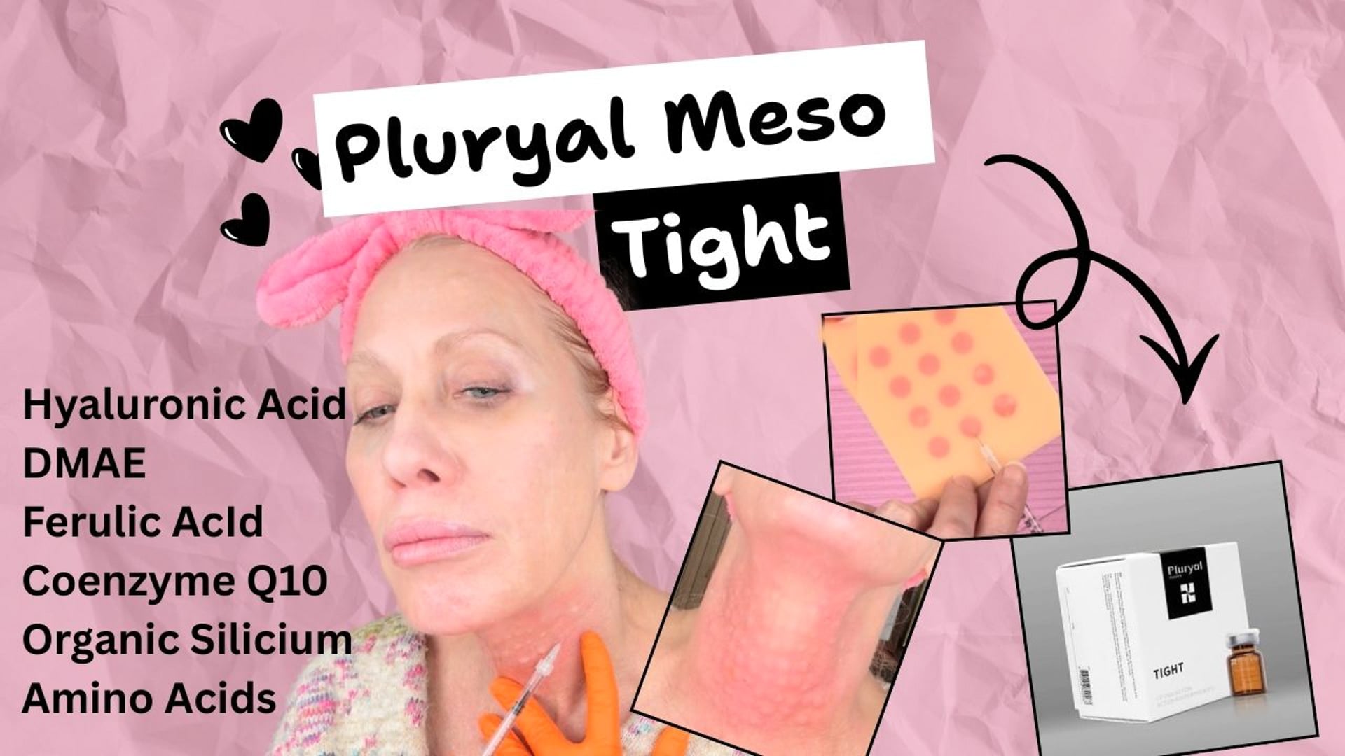 Pluryal Tight Neck Treatment - Improving Crepey Skin & Laxity