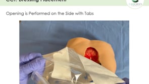 Related Embedded Video Item Thumbnail