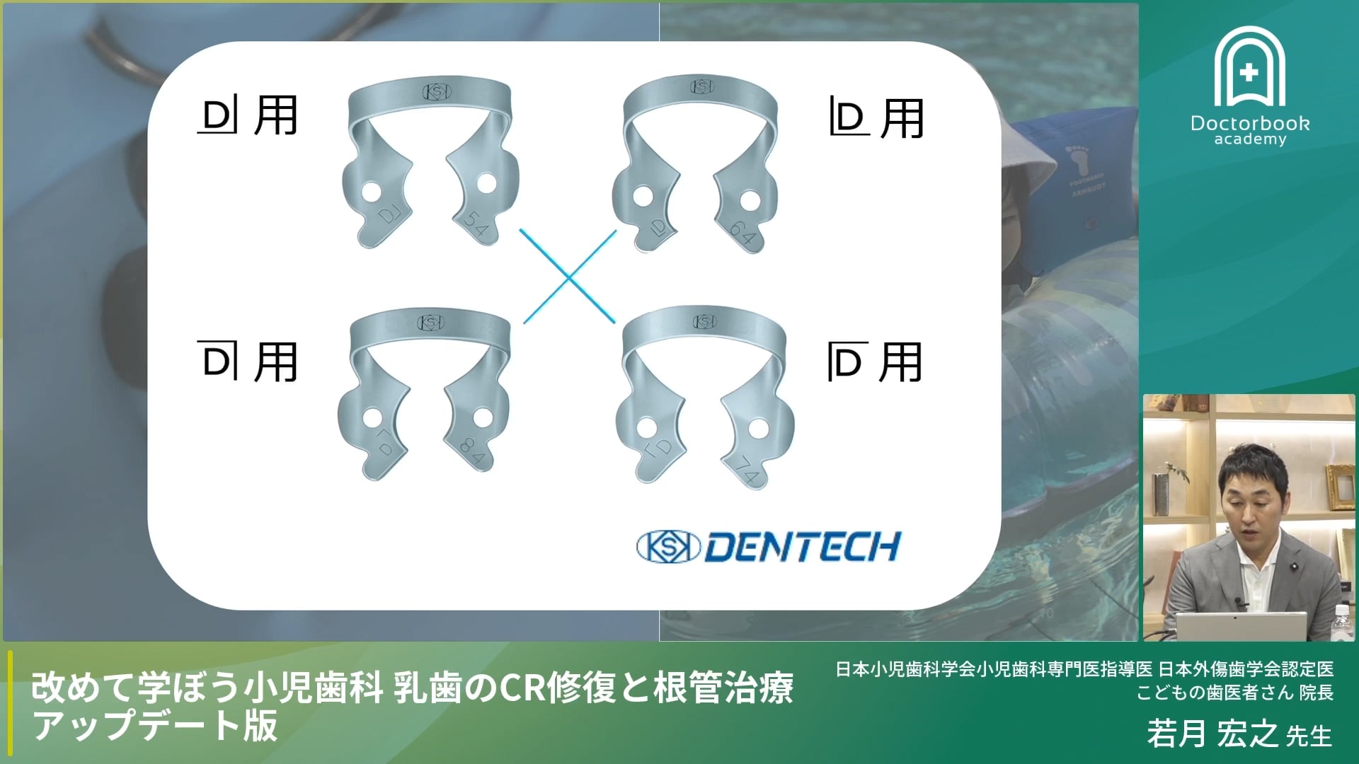 臨床知見録_乳歯のコンポジットレジン修復_ラバーダムのクランプ選択