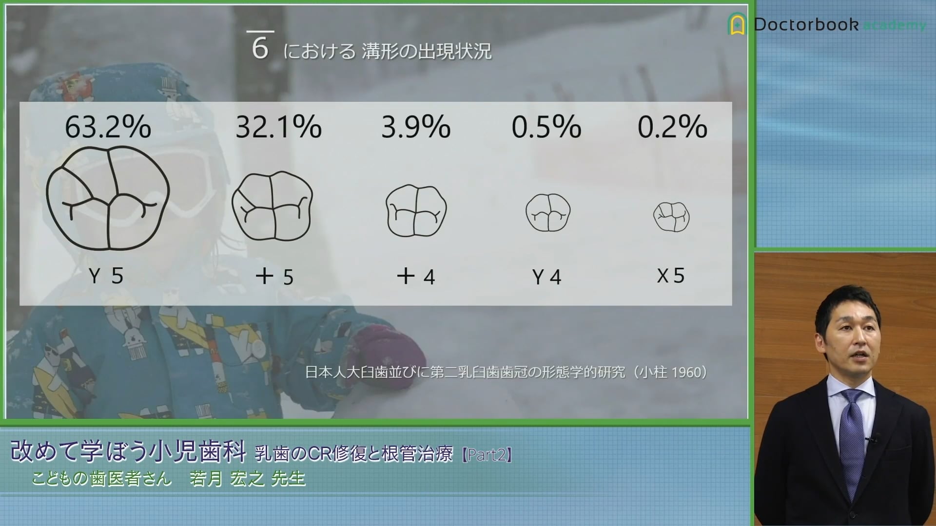 臨床知見録_乳歯のコンポジットレジン修復_Y5を目安に咬合面を作る