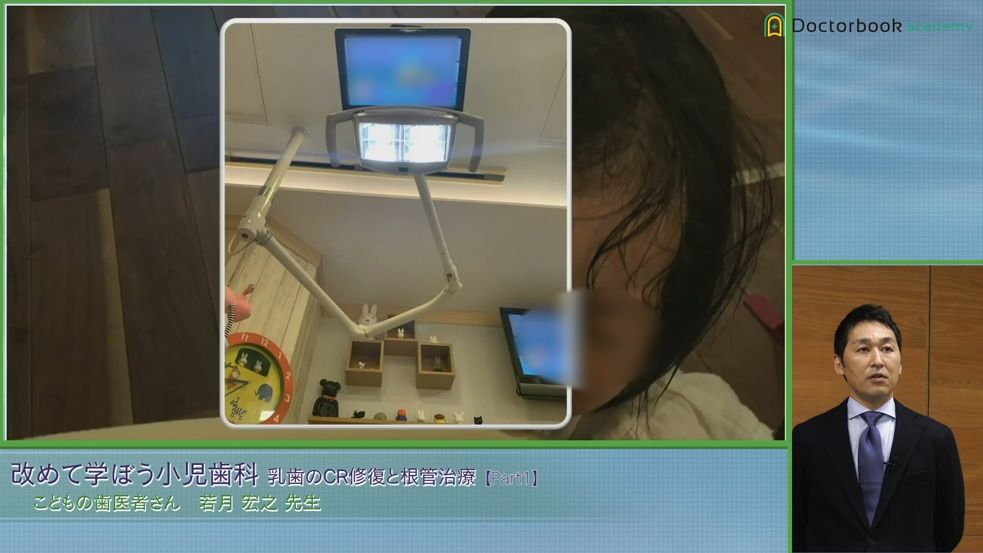 臨床知見録_乳歯のコンポジットレジン修復_スマイルタッチ