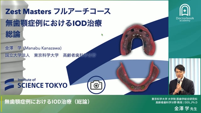 無歯顎症例におけるIOD治療（総論）