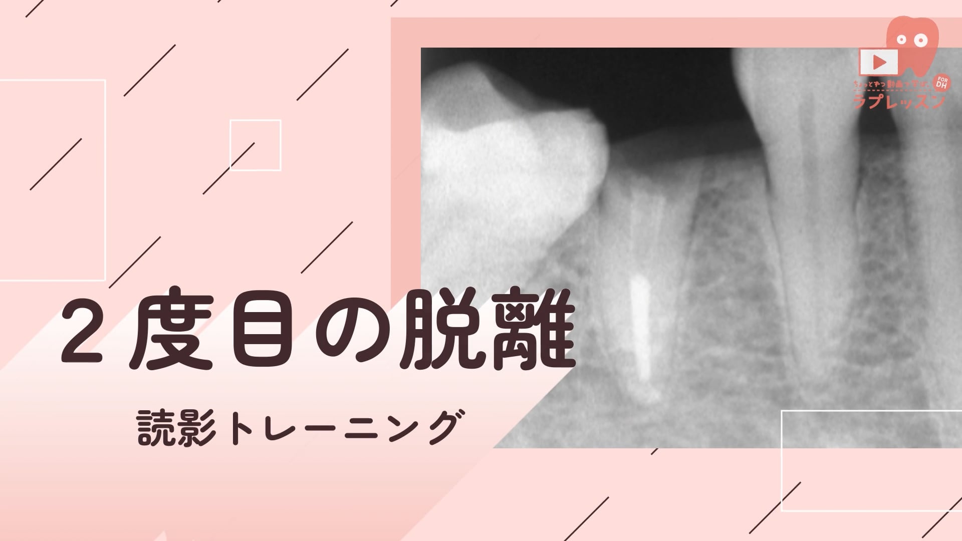 04.２度目の脱離