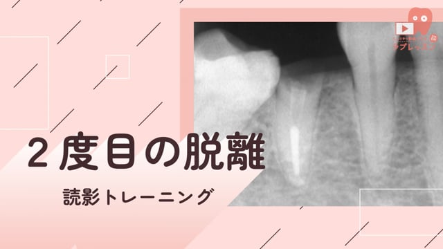 04.２度目の脱離