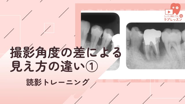 07.撮影角度による見え方の違い①