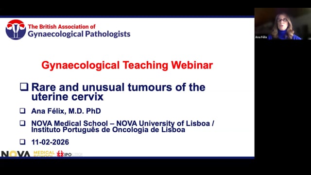 Rare unusual tumours of the uterine cervix