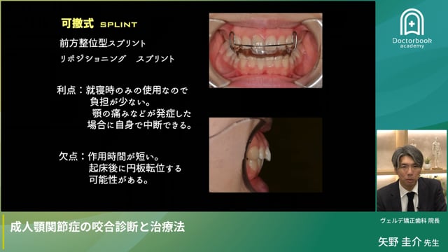 成人顎関節症の咬合診断と治療法
