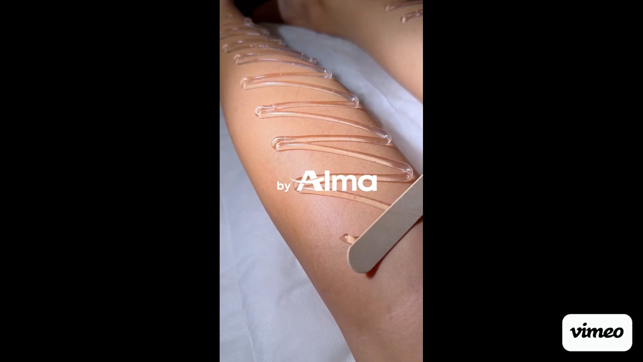 Alma Soprano Titanium SE