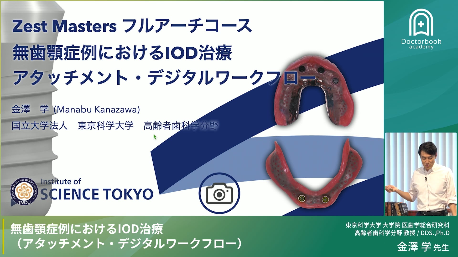 無歯顎症例におけるIOD治療（アタッチメント・デジタルワークフロー）