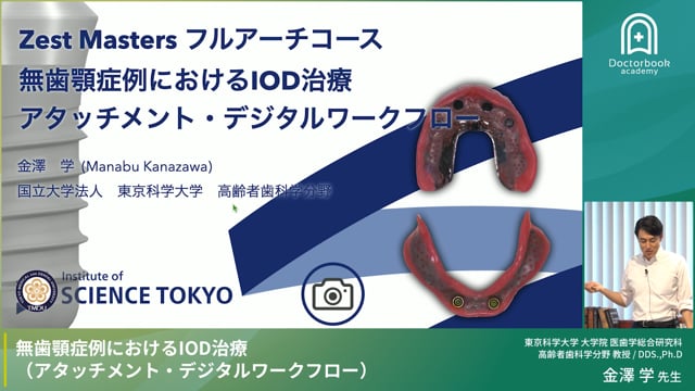 無歯顎症例におけるIOD治療（アタッチメント・デジタルワークフロー）