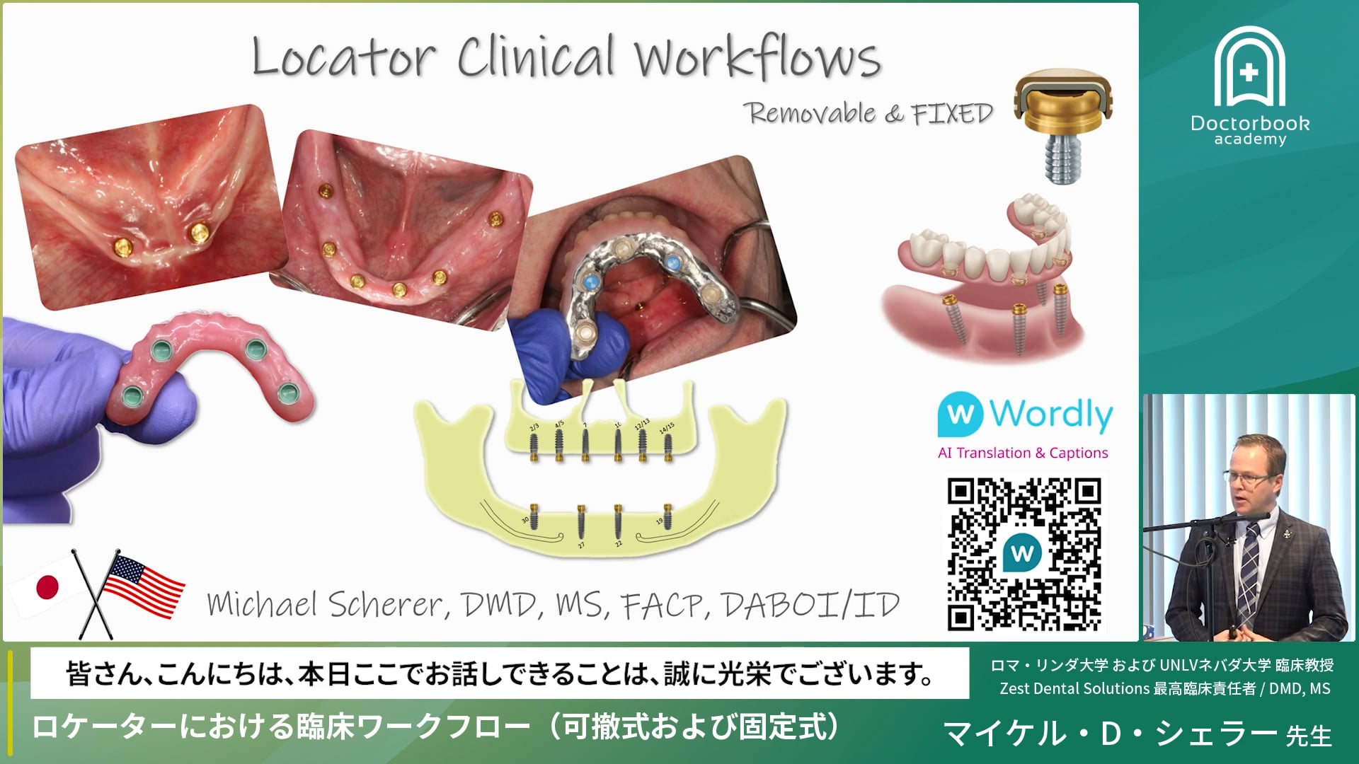 ロケーターにおける臨床ワークフロー（可撤式および固定式）