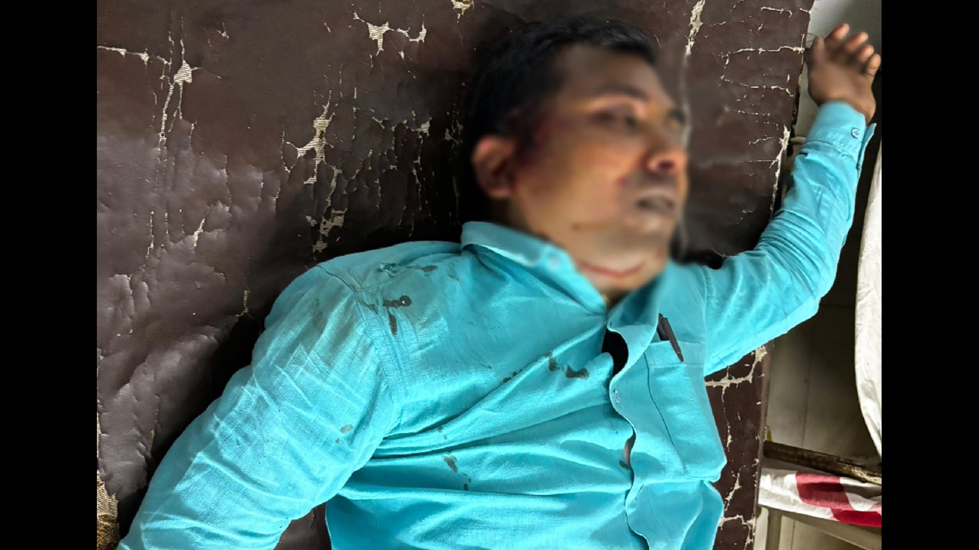 रजौन्ध गांव के समीप बाइक दुर्घटना में युवक गंभीर रूप से जख्मी