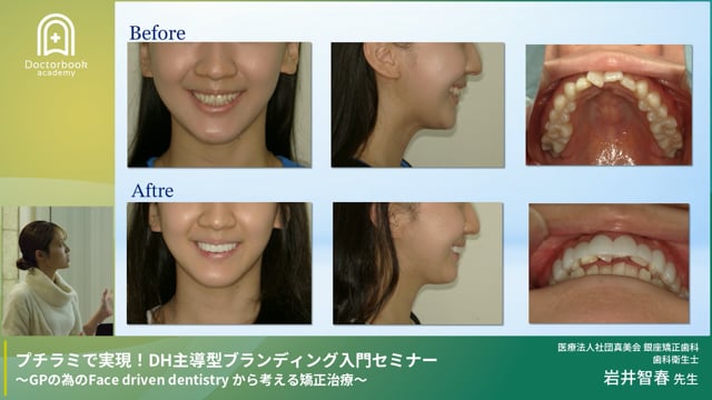 DH主導で価値を創るプチラミ導入戦略 ブランディングと実践フロー完全解説